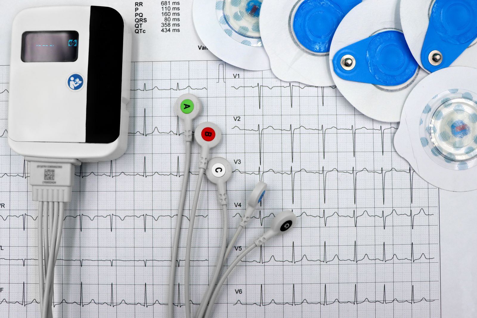 Holter 24 horas